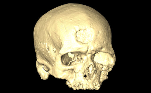 MNHN-HA-4253-1 Cranium