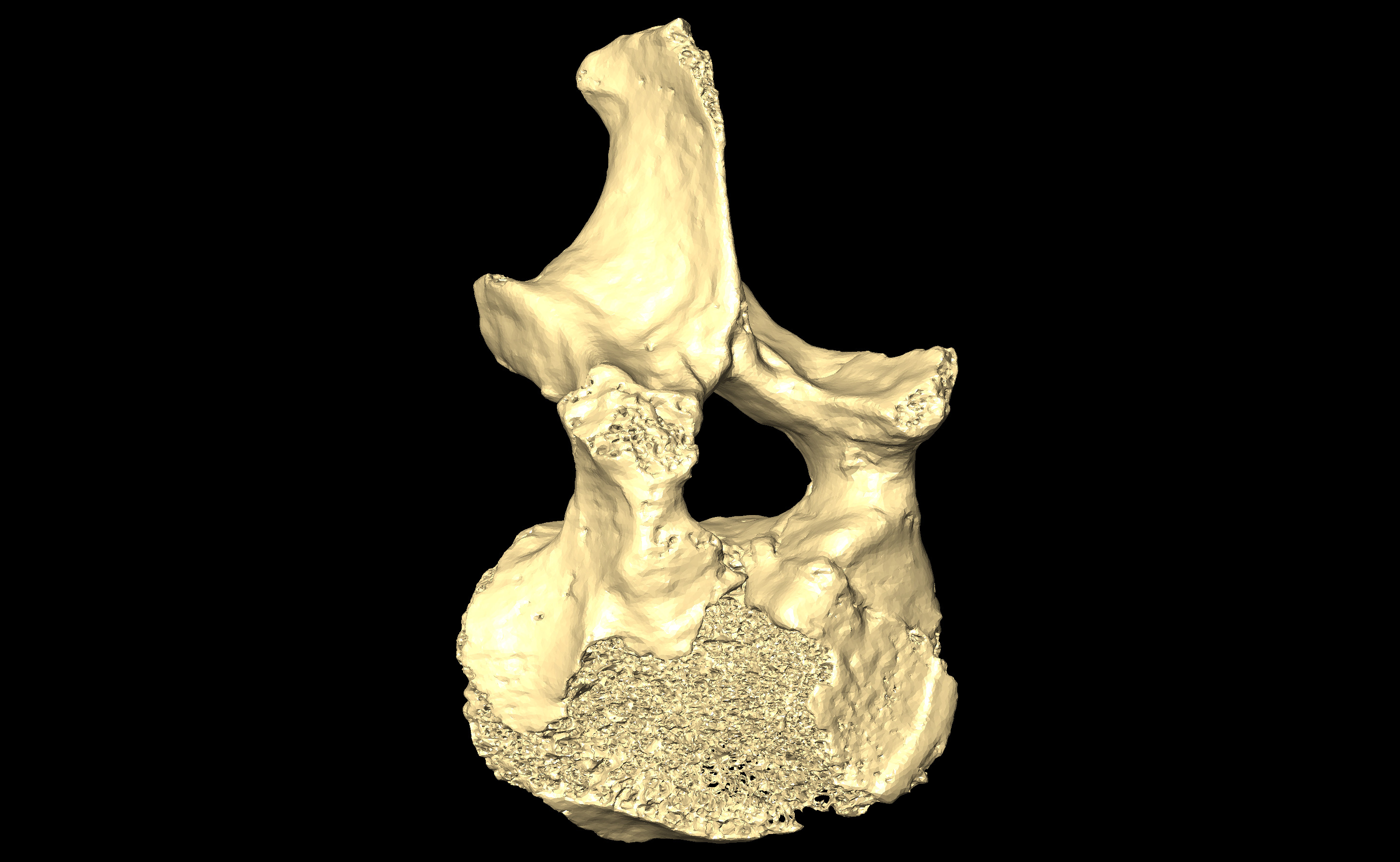 MNHN-HA-4268-2 (N° SV: 4268-VL) Lumbar Vertebra