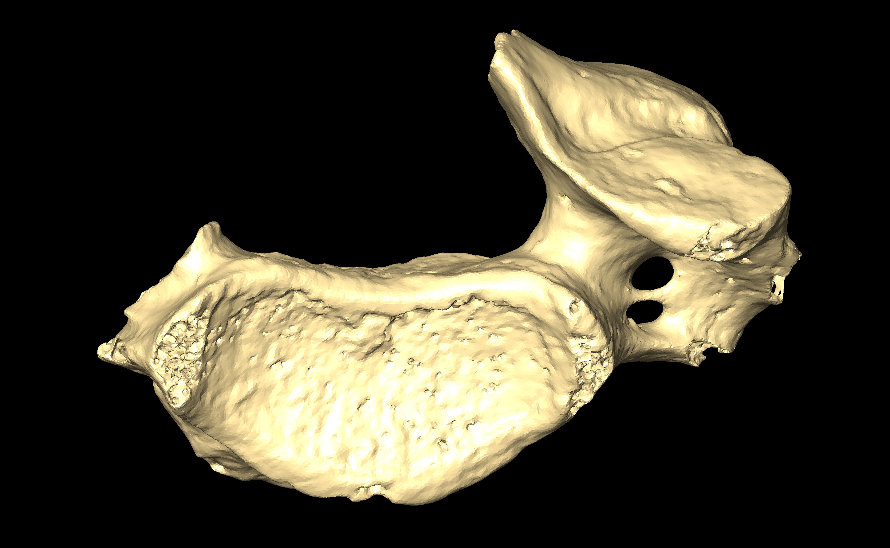 MNHN-HA-4268-1 (N° SV: 4268-VC) Cervical Vertebra