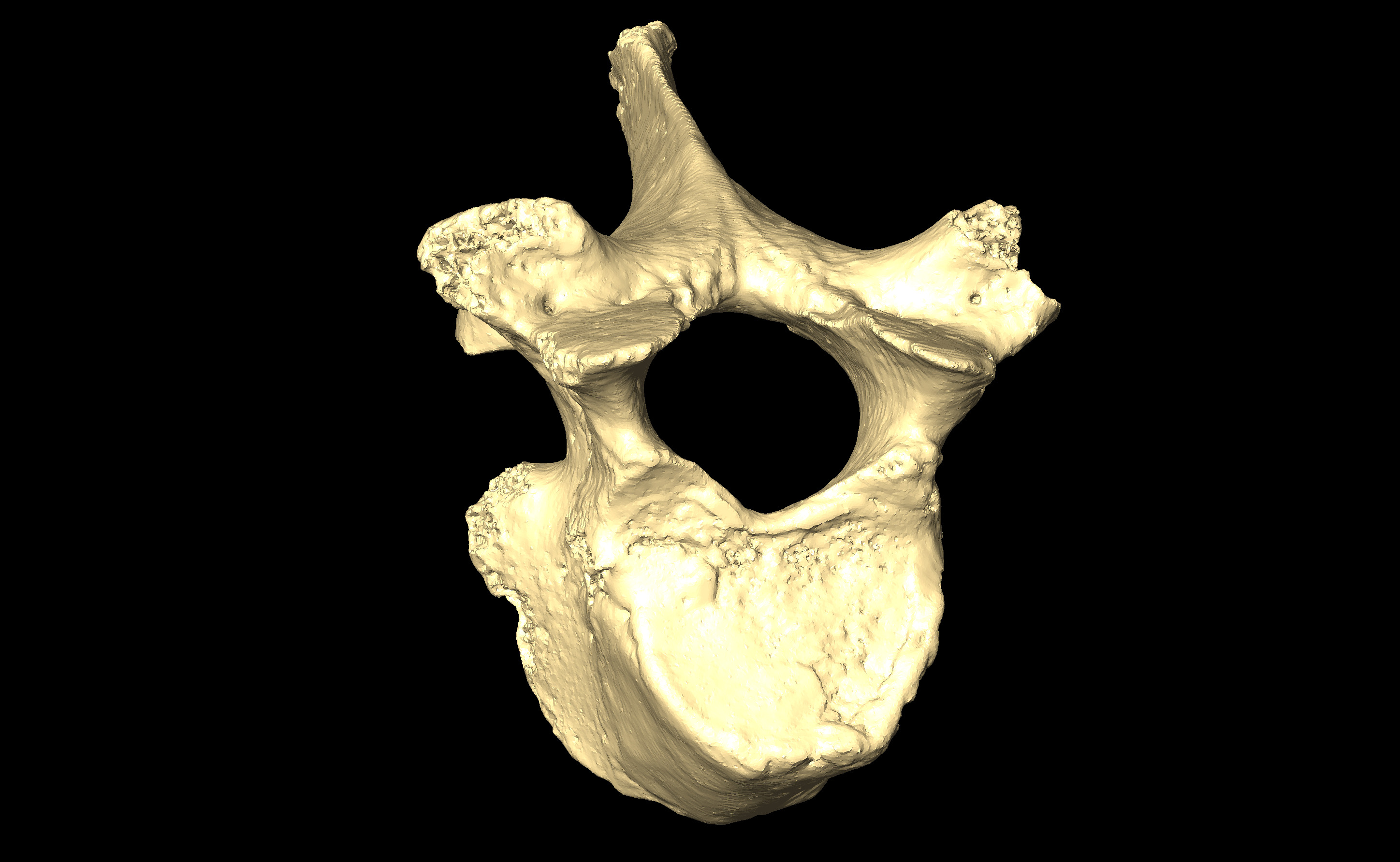 MNHN-HA-4274 Thoracic Vertebra