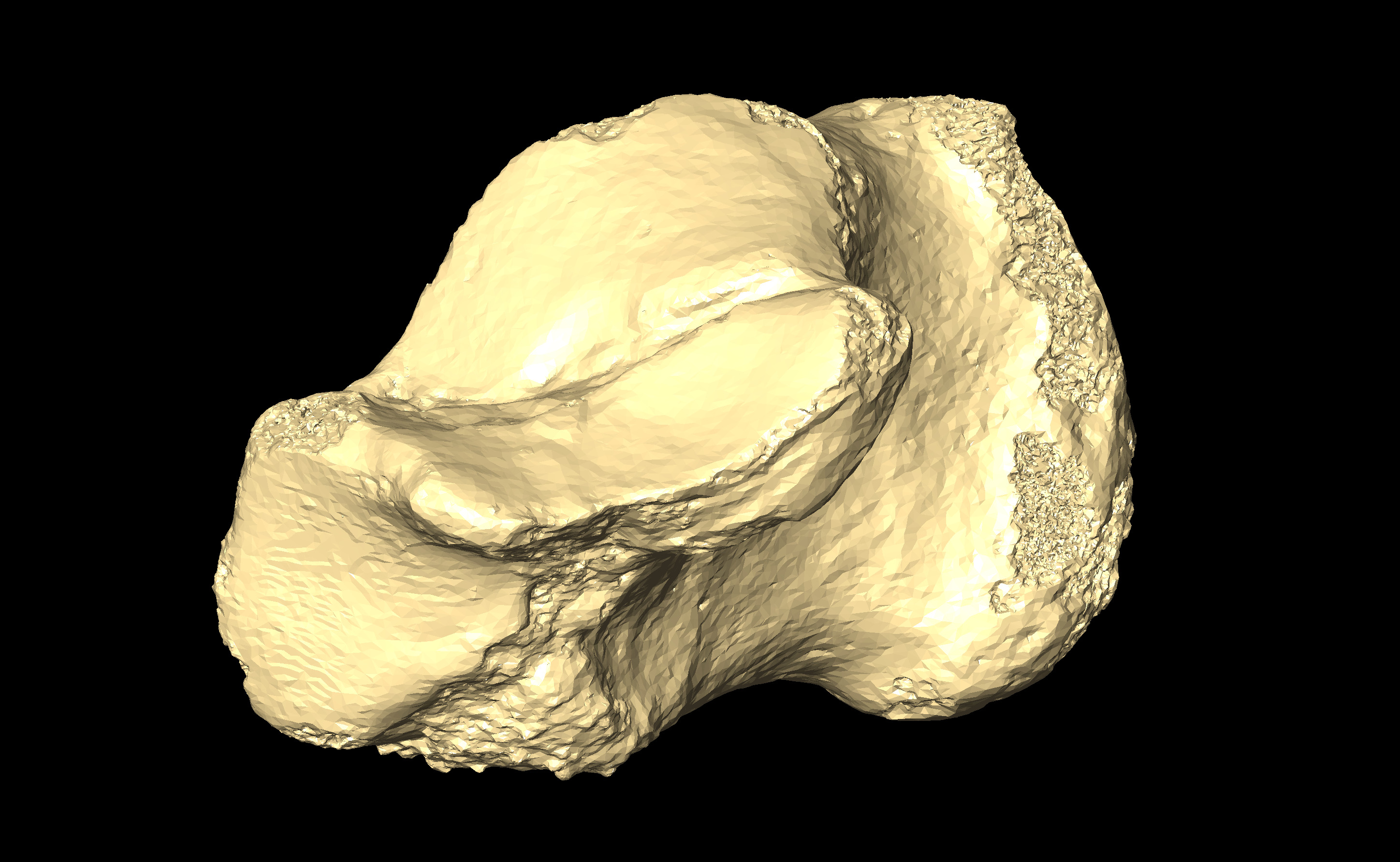 MNHN-HA-4336 Right Calcaneus