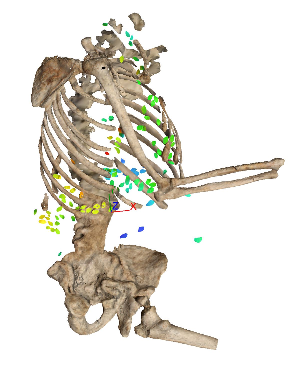AVIGNON_BALANCE_BURIAL