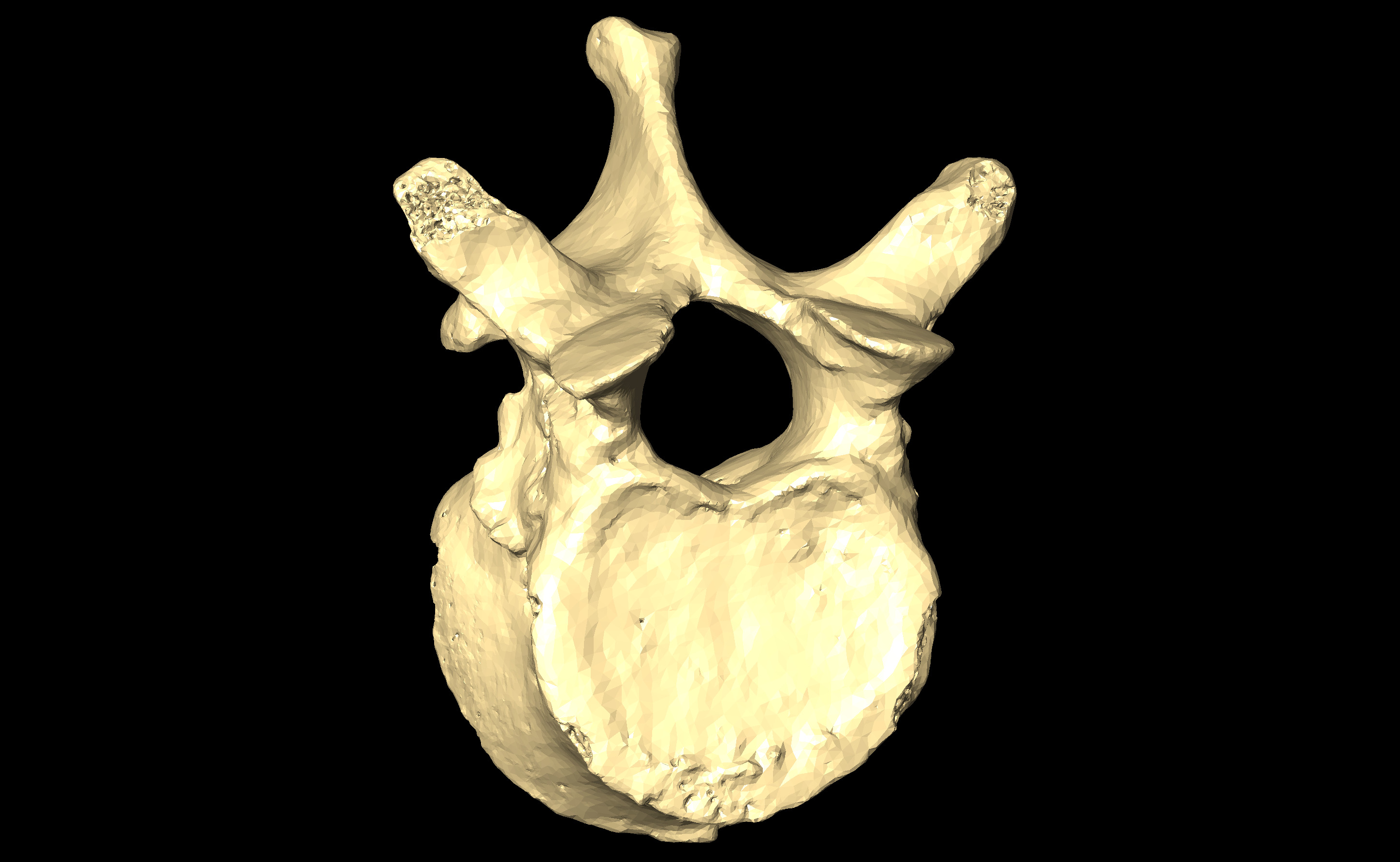 MNHN-HA-4269-bis Thoracic Vertebra