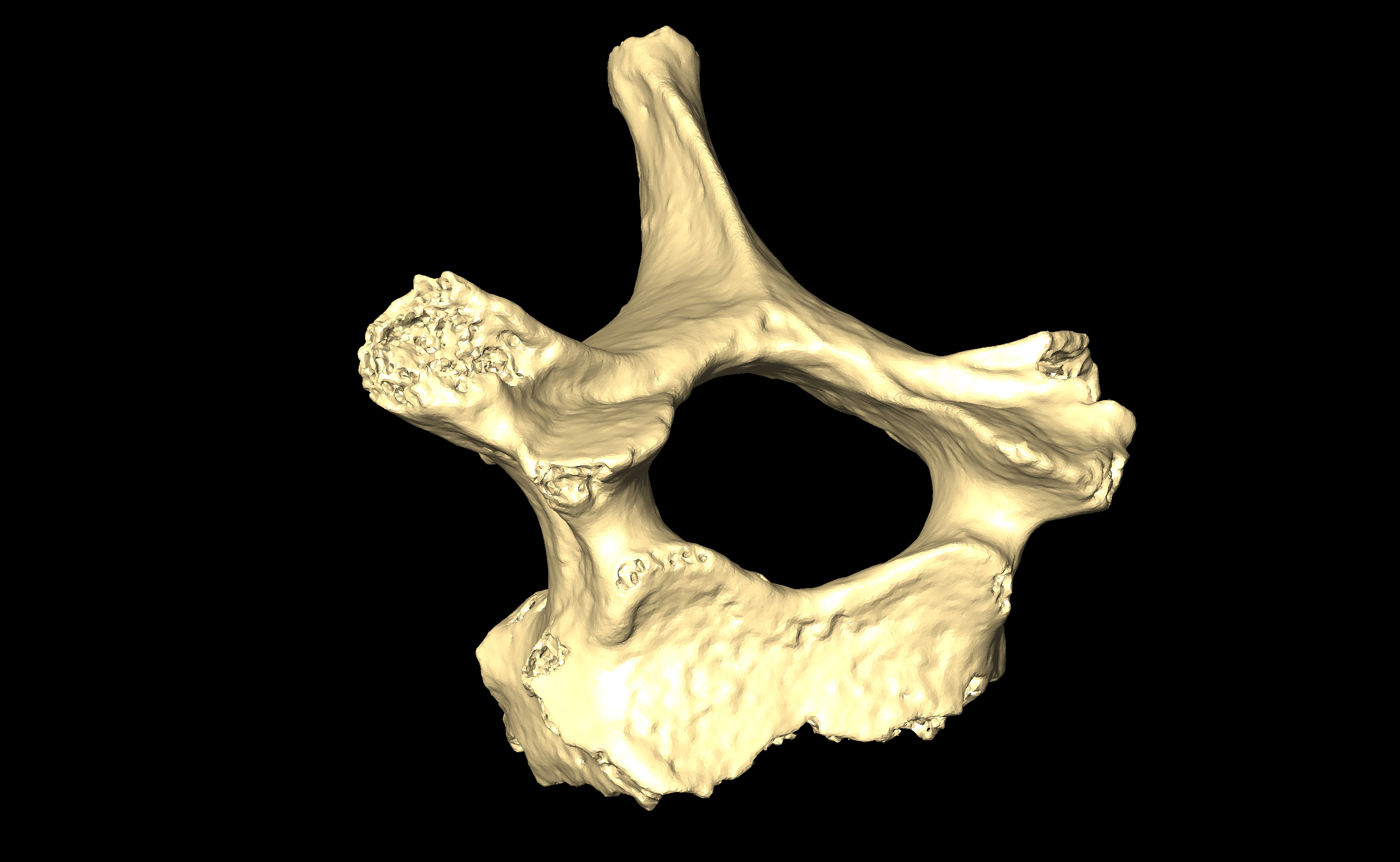 MNHN-HA-4273 Thoracic Vertebra