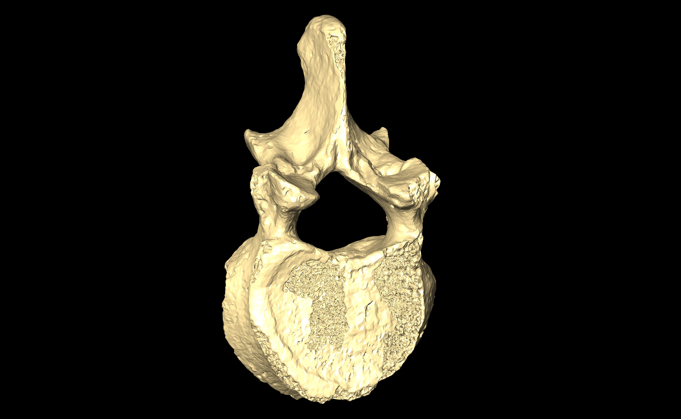 MNHN-HA-4282 Lumbar Vertebra