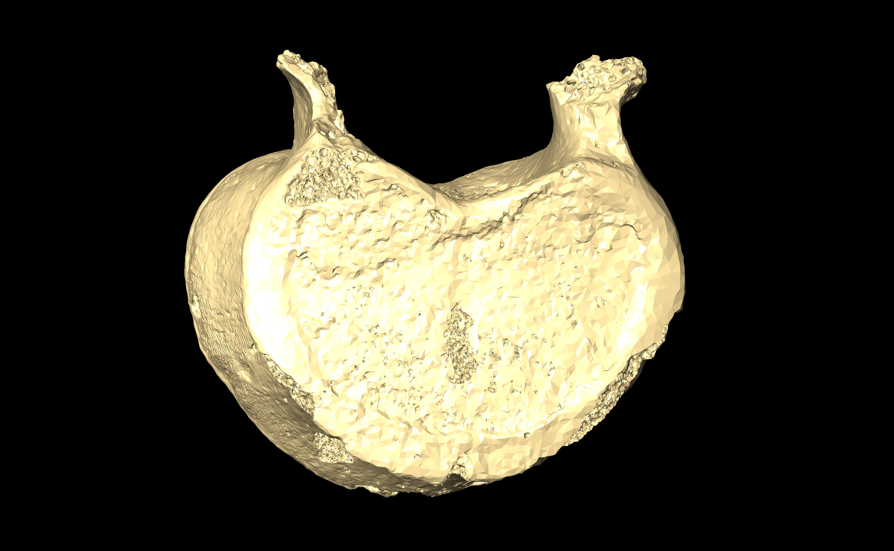 MNHN-HA-4284 Lumbar Vertebra