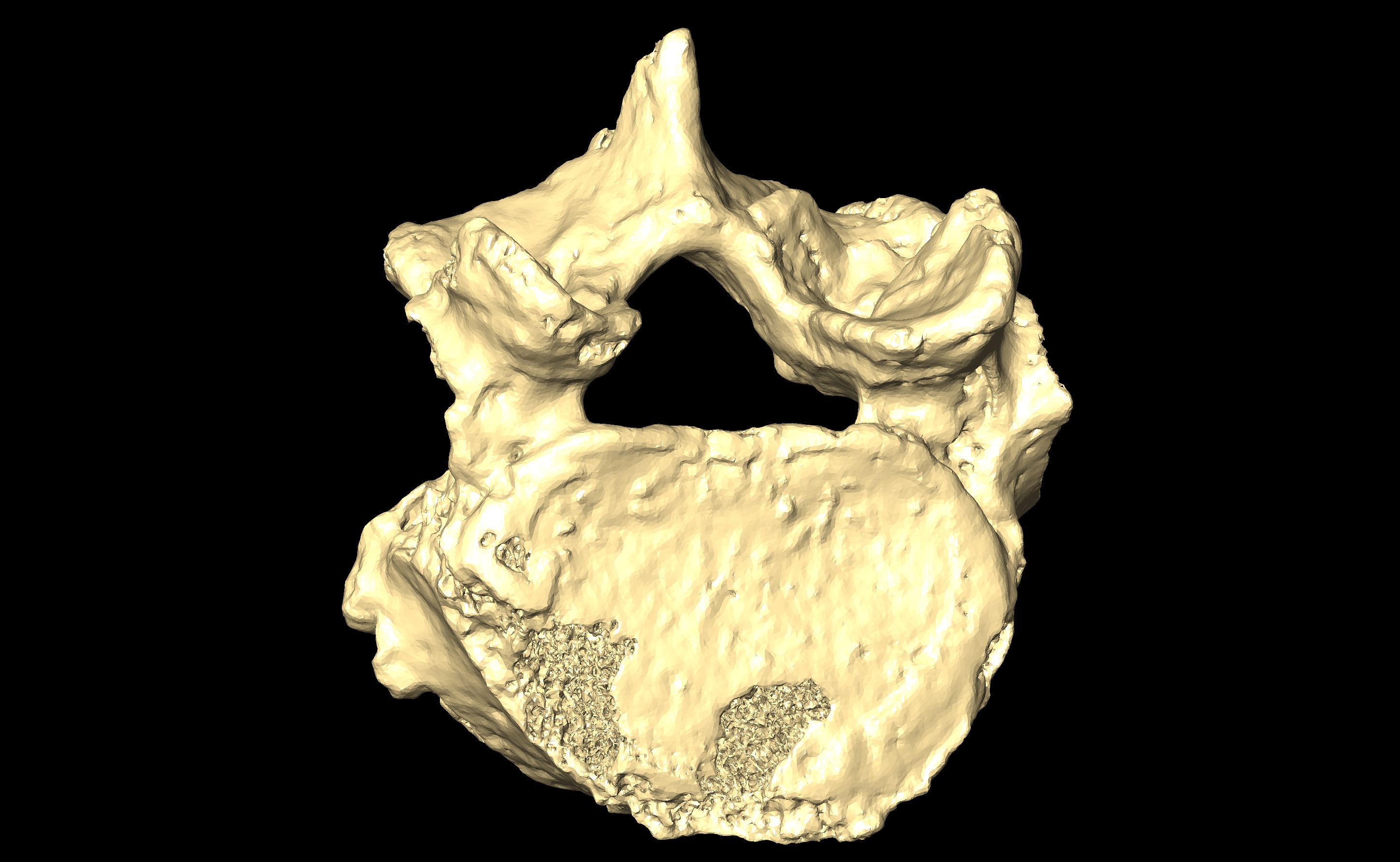 MNHN-HA-4289 Lumbar Vertebra 5